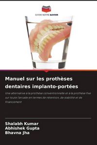 Produktbild: Manuel sur les proth&egrave;ses dentaires implanto-port&eacute;es