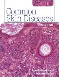 Produktbild: Common Skin Diseases 18th /e 1