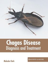 Produktbild: Chagas Disease: Diagnosis and Treatment
