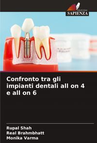 Produktbild: Confronto tra gli impianti dentali all on 4 e all on 6