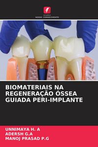 Produktbild: BIOMATERIAIS NA REGENERA&Ccedil;&Atilde;O &Oacute;SSEA GUIADA PERI-IMPLANTE
