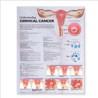 Produktbild: Understanding Cervical Cancer
