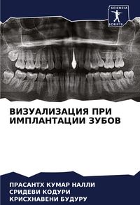 Produktbild: Vizualizaciya Pri Implantacii Zubov
