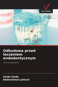 Produktbild: Odbudowa przed leczeniem endodontycznym