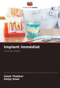 Produktbild: Implant imm&eacute;diat