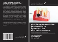 Produktbild: Cirug&iacute;a piezoel&eacute;ctrica en la colocaci&oacute;n de implantes: Una alternativa moderna