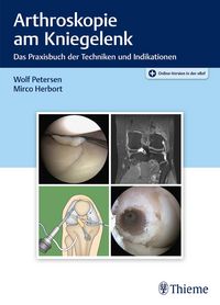 Produktbild: Arthroskopie am Kniegelenk