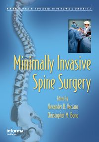 Produktbild: Minimally Invasive Spine Surgery