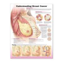 Produktbild: Understanding Breast Cancer Anatomical Chart