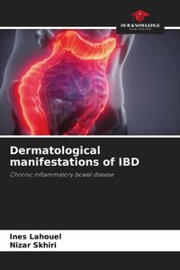 Produktbild: Lahouel, I: Dermatological manifestations of IBD