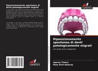 Produktbild: Riposizionamento spontaneo di denti patologicamente migrati