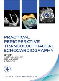 Produktbild: Practical Perioperative Transoesophageal Echocardiography