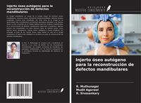 Produktbild: Injerto &oacute;seo aut&oacute;geno para la reconstrucci&oacute;n de defectos mandibulares