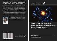 Produktbild: Im&aacute;genes De Fusi&oacute;n - Aplicaci&oacute;n En Im&aacute;genes Maxilofaciales