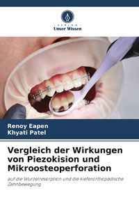 Produktbild: Vergleich der Wirkungen von Piezokision und Mikroosteoperforation