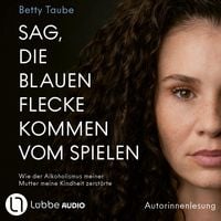 Produktbild: Sag, die blauen Flecke kommen vom Spielen