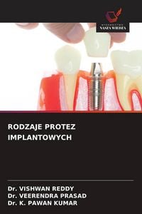 Produktbild: Rodzaje Protez Implantowych