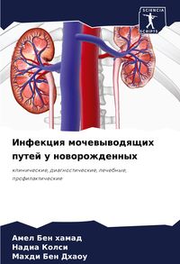 Produktbild: Infekciq mochewywodqschih putej u noworozhdennyh