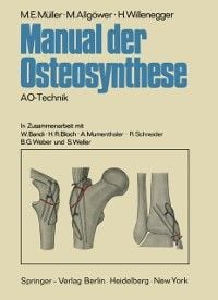 Produktbild: Manual der Osteosynthese