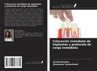Produktbild: Colocaci&oacute;n inmediata de implantes y protocolo de carga inmediata