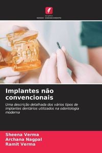 Produktbild: Implantes n&atilde;o convencionais