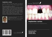 Produktbild: Implantes cortos