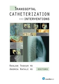Produktbild: Transseptal Catheterization and Interventions
