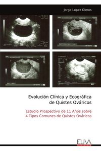 Produktbild: Evoluci&oacute;n Cl&iacute;nica y Ecogr&aacute;fica de Quistes Ov&aacute;ricos
