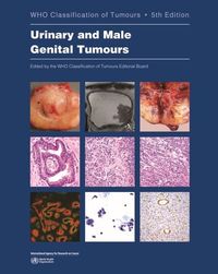Produktbild: Urinary and Male Genital Tumours