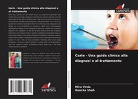 Produktbild: Carie - Una guida clinica alla diagnosi e al trattamento