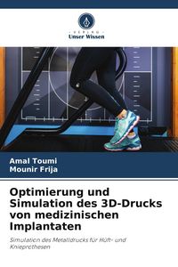 Produktbild: Optimierung und Simulation des 3D-Drucks von medizinischen Implantaten