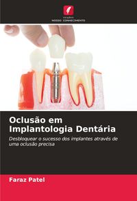 Produktbild: Oclus&atilde;o em Implantologia Dent&aacute;ria