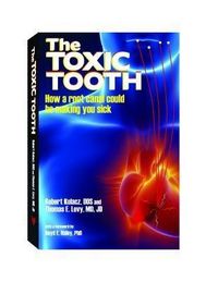Produktbild: The Toxic Tooth