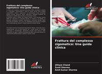 Produktbild: Frattura del complesso zigomatico