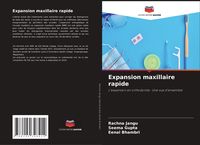 Produktbild: Expansion maxillaire rapide