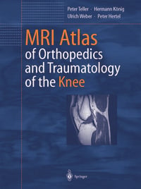 Produktbild: MRI Atlas of Orthopedics and Traumatology of the Knee