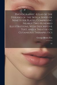 Produktbild: Photographic Atlas of the Diseases of the Skin; a Series of Ninety-six Plates, Comprising Nearly two Hundred Illustrations, With Descriptive Text, and