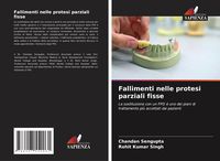 Produktbild: Fallimenti nelle protesi parziali fisse