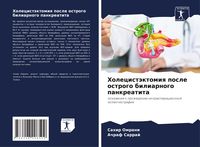 Produktbild: Holecist&auml;ktomiq posle ostrogo biliarnogo pankreatita