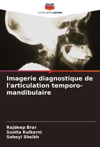 Produktbild: Imagerie diagnostique de l'articulation temporo-mandibulaire