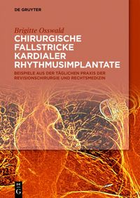 Produktbild: Chirurgische Fallstricke kardialer Rhythmusimplantate
