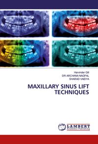 Produktbild: Maxillary Sinus Lift Techniques