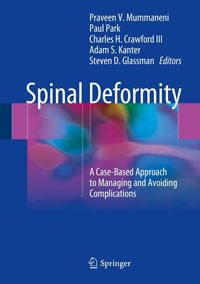 Produktbild: Spinal Deformity