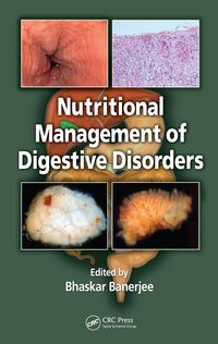 Produktbild: Nutritional Management of Digestive Disorders