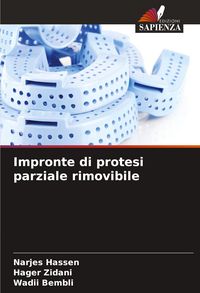 Produktbild: Impronte di protesi parziale rimovibile