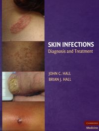 Produktbild: Hall, B: Skin Infections
