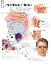 Produktbild: Understanding Rhinitis Chart