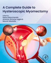 Produktbild: A Complete Guide to Hysteroscopic Myomectomy
