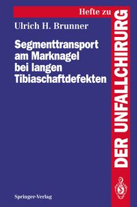 Produktbild: Segmenttransport am Marknagel bei langen Tibiaschaftdefekten