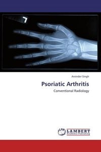 Produktbild: Singh, A: Psoriatic Arthritis